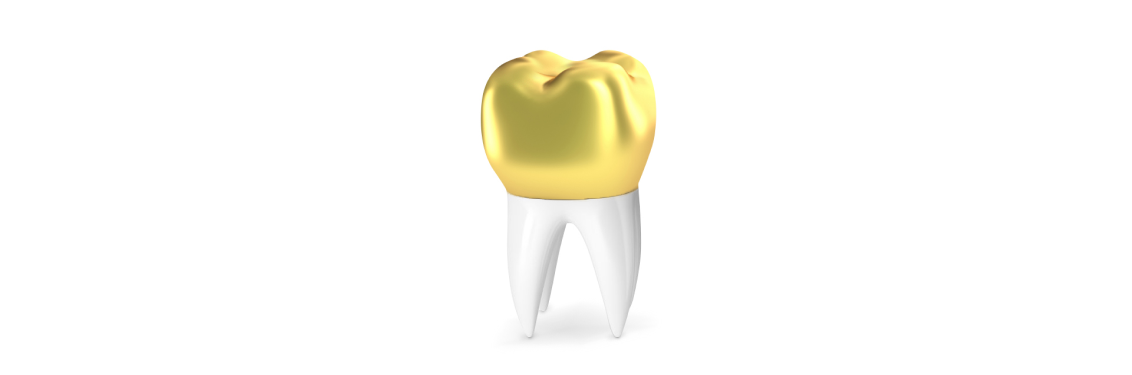 Золотые коронки на зубы