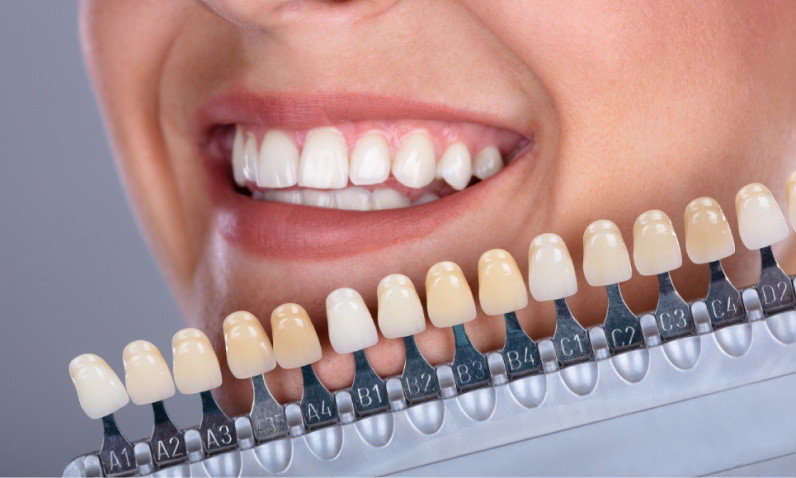Секреты правильного ухода за зубами и полостью рта. Автор Алина Колякина